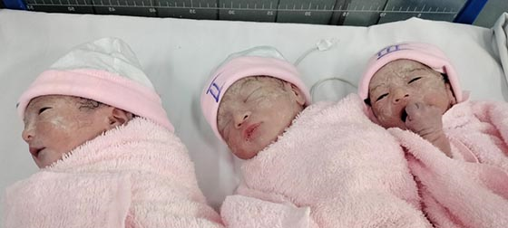 3 bé gái chào đời an toàn