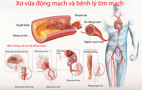 Nguồn Internet