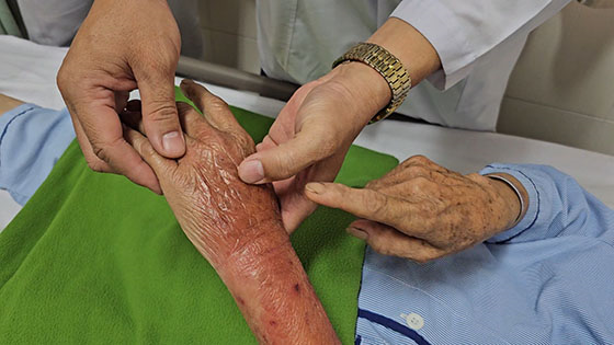 Một số loại côn trùng như ong, kiến có nọc độc và vết cắn của chúng có thể gây ra phản ứng dị ứng nghiêm trọng.