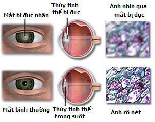__c th_y tinh th_ (_nh PVC ngu_n Iternet) (2).jpg
